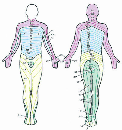 Transforaminal epidural steroid injection risks